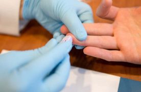 Дзержинцы могут пройти экспресс-тестирование на ВИЧ.